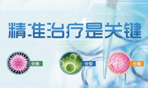 治疗白癜风采用什么方法好